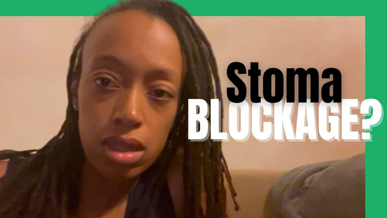 My Stoma Suddenly Changed. Here's What Happened...