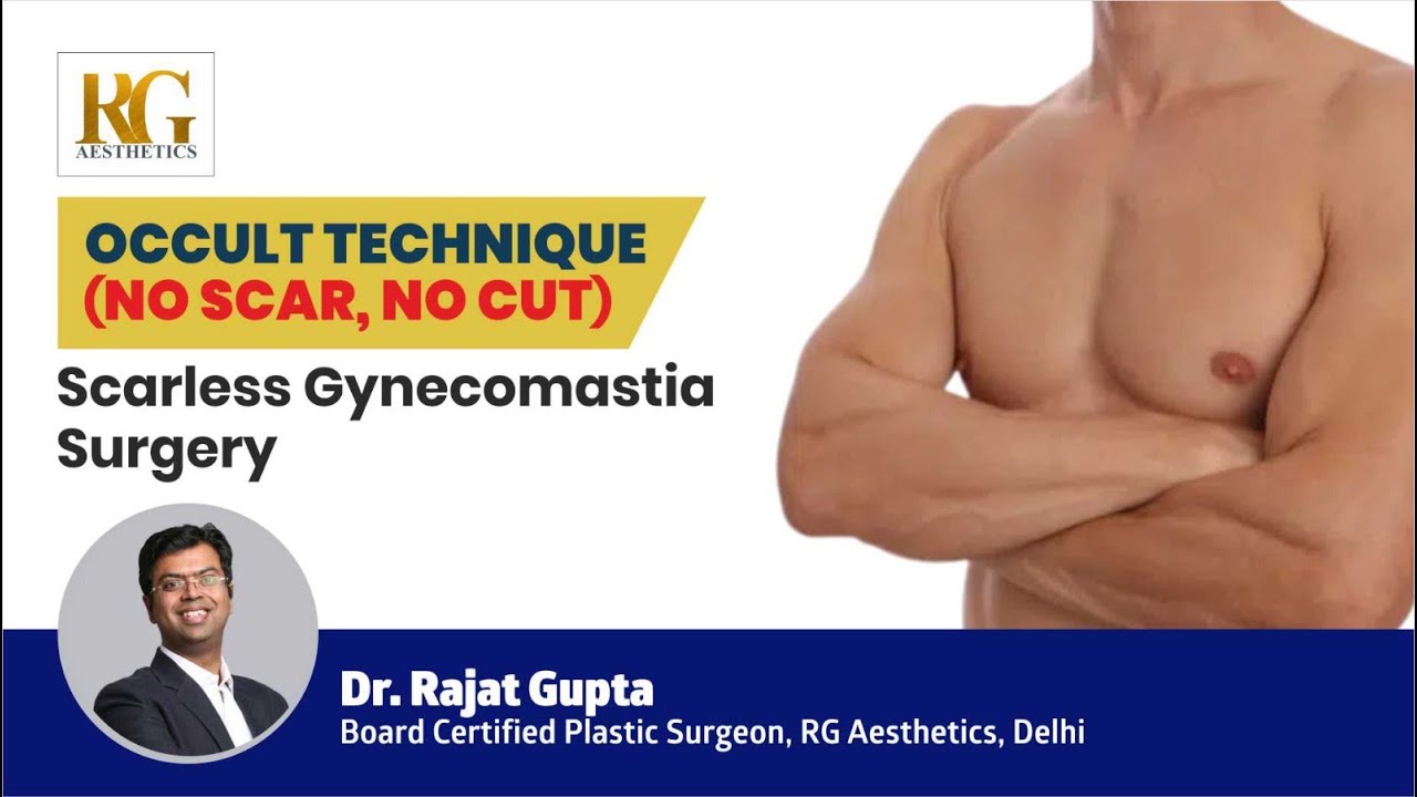 OCULT Technique (No Scar, No Cut) | Scarless Gynecomastia Surgery in Delhi | Dr Rajat Gupta, Delhi