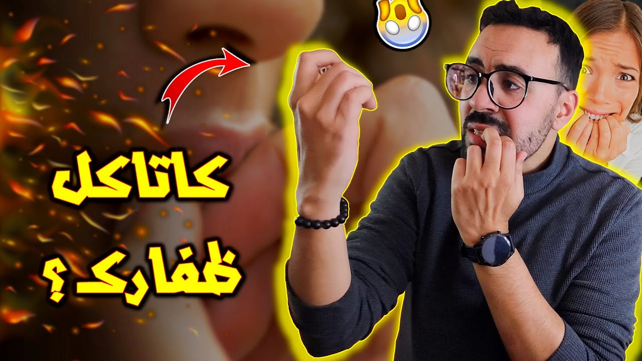 كاتاكل ظفارك ؟؟ - ضروري تشوف هاد الفيديو 🚨
