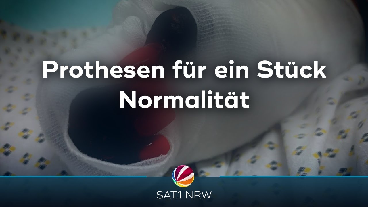 Prothesen für ein Stück Normalität