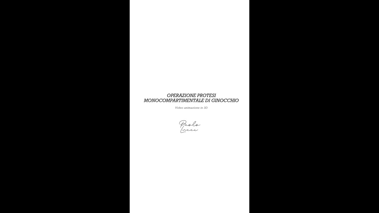 Protesi Monocompartimentale di Ginocchio - Dott. Paolo Lucci