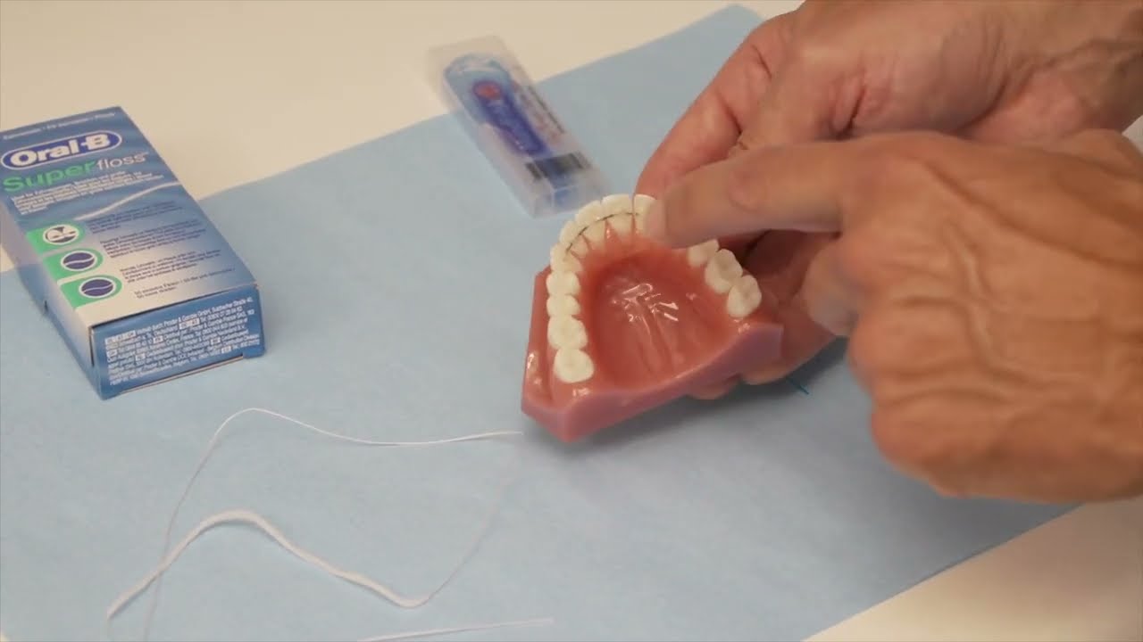 Guide til tandtråd under metaltråd (retentionstråd)