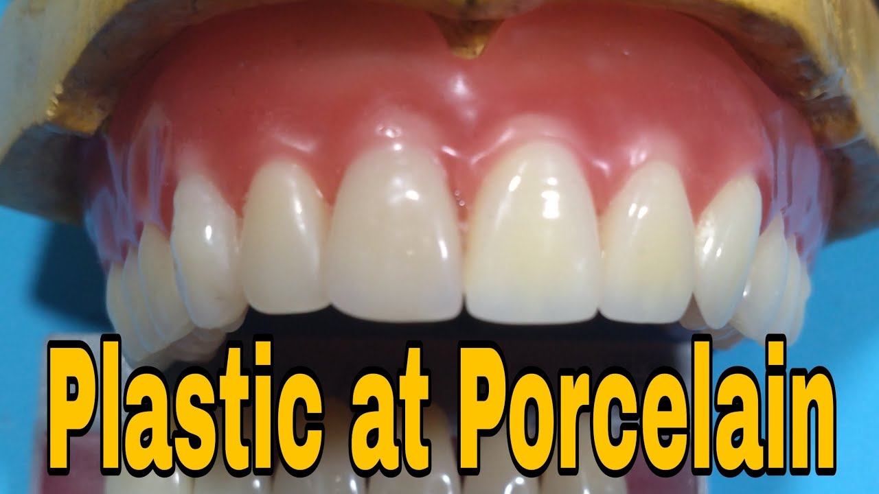 Pagkakaiba ng Plastic/Acrylic Teeth and Porcelain Teeth, Ngipin sa pustiso.