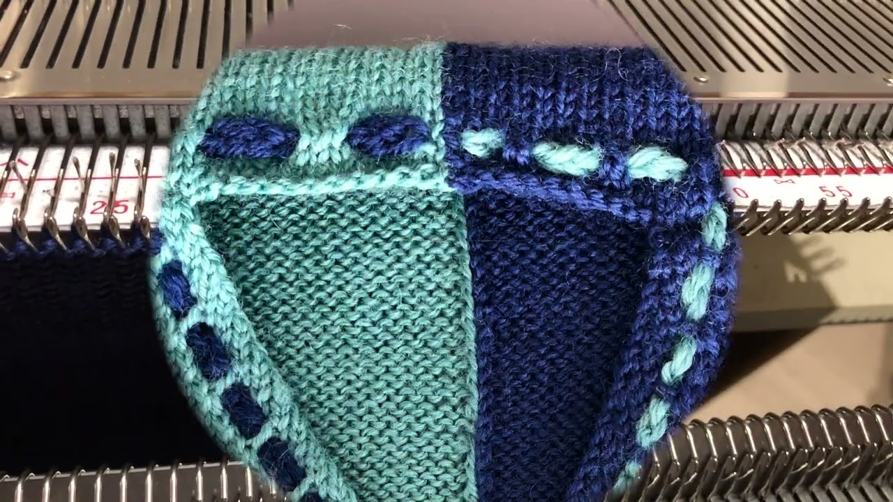 I-Cord stricken bei gleichzeitiger Abnahme