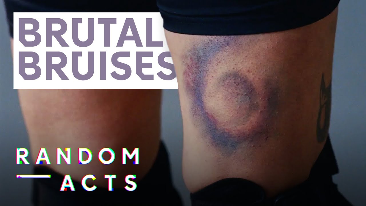 Brutal Bruises from Roller Derby | Derby Kiss by Fanny Hoetzeneder | Doc Film | Random Acts