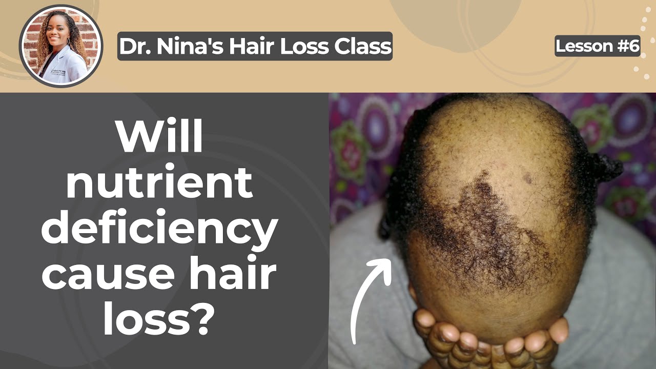 Dr. Nina's Hair Loss Class | Lesson 06 - Will nutrient deficiency cause hair loss?