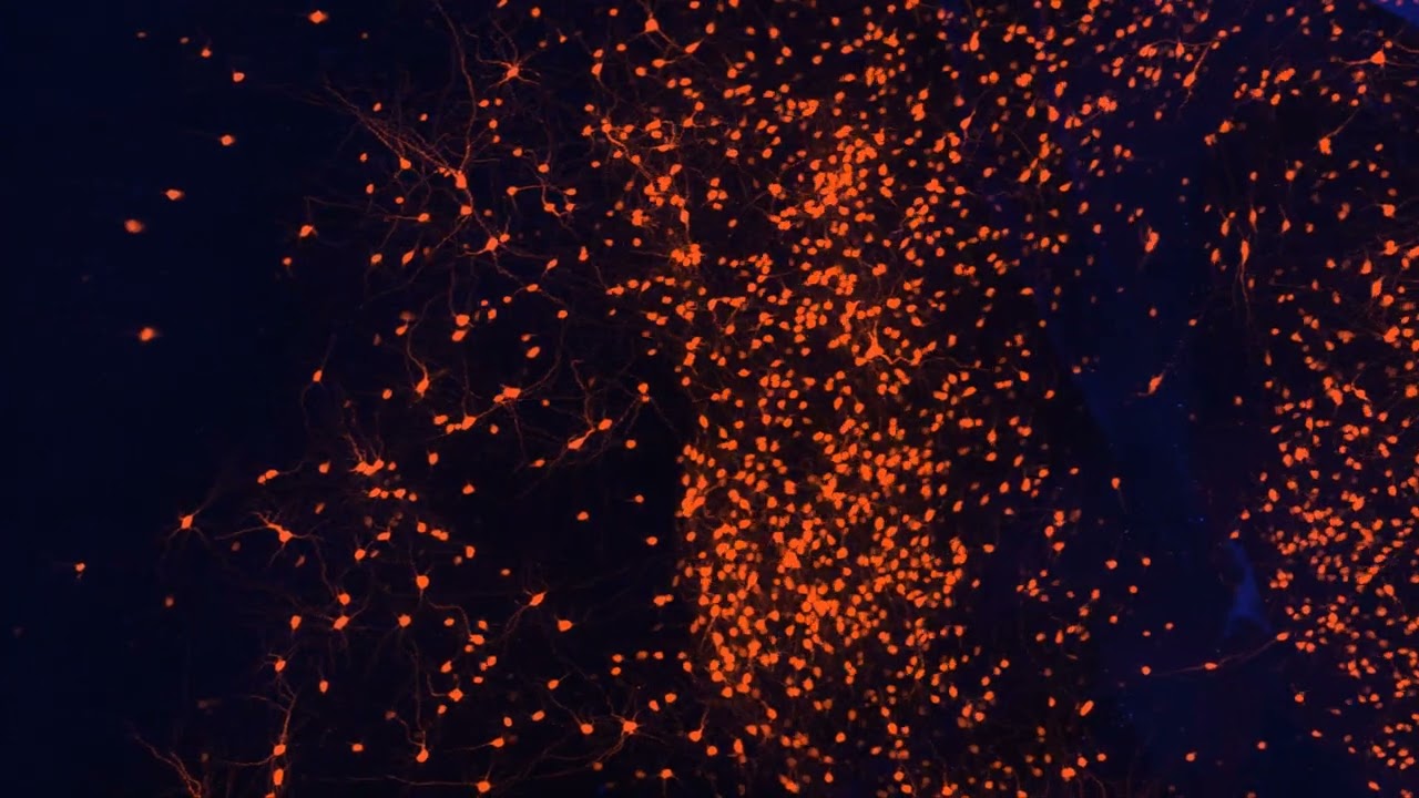Amygdala Inputs to BST MC3R Neurons