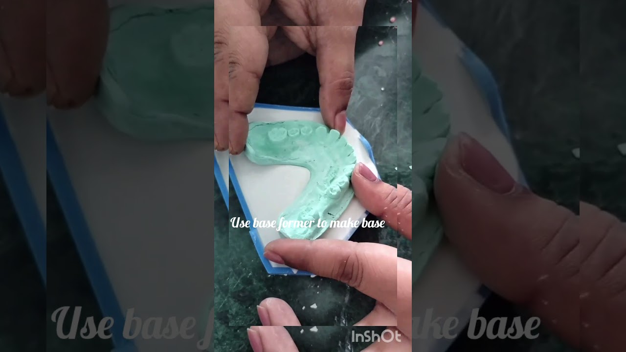 Dental cast base making #art #shortsfeed #ytshorts #dentist #viralvideo #college #bds