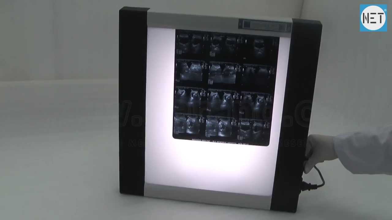 X-Ray Viewer with Led Light, Single Film. Item Code: DP302