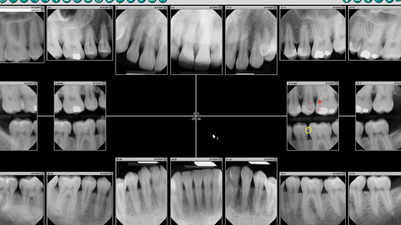 DEXIS&trade; Imaging Suite - Patient Screen Overview