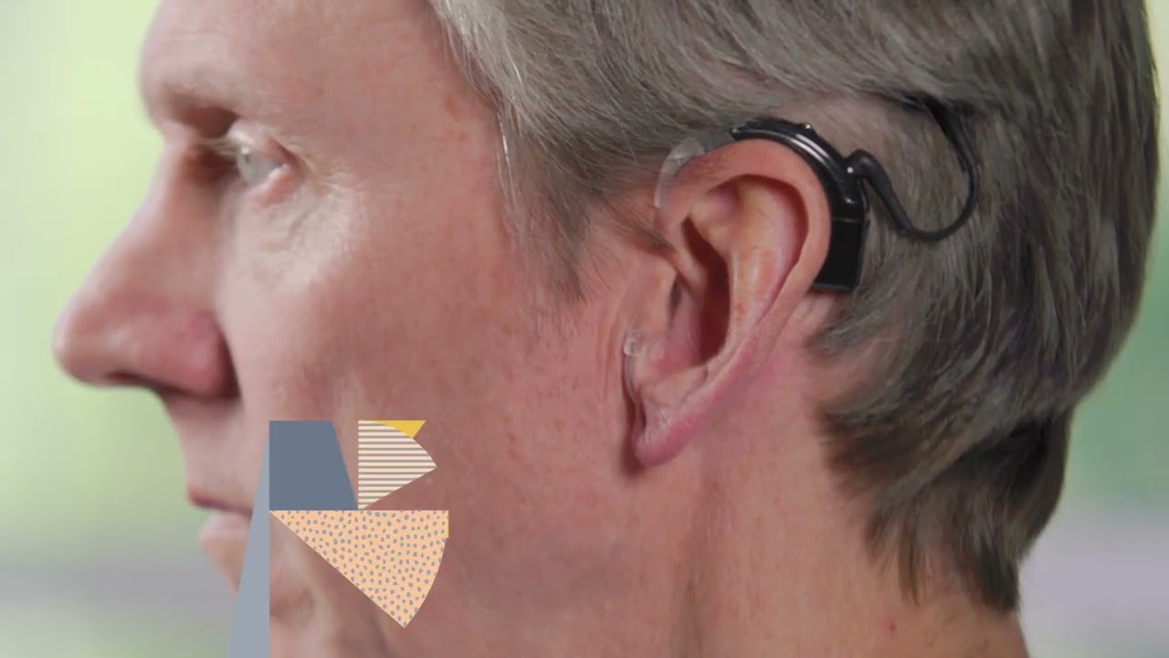 Nucleus 8 Sound Processor | Wearing options for adults | Cochlear