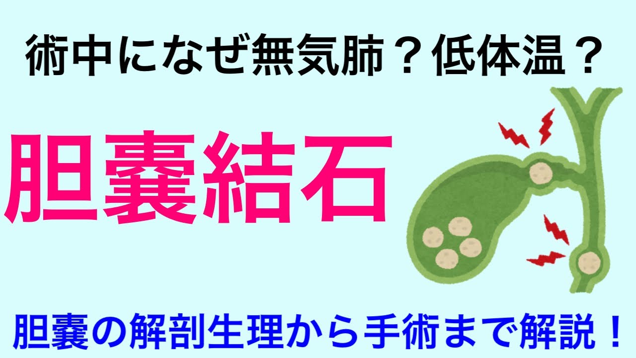 胆嚢結石について解説！