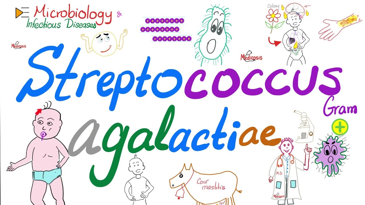 Streptococcus agalactiae (Group B Strept or GBS)...Neonatal Meningitis, sepsis, pneumonia