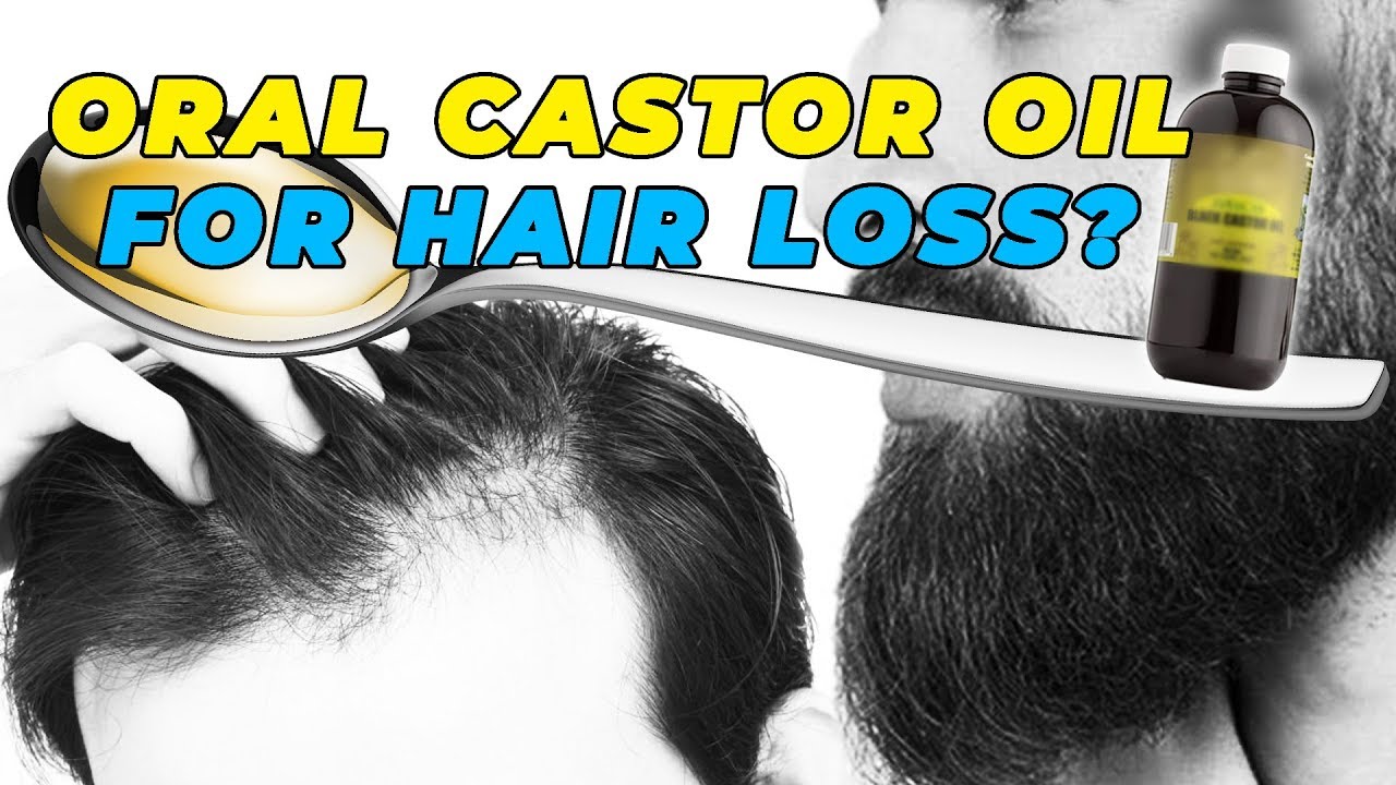Oral Castor Oil For Hair Loss Prevention?