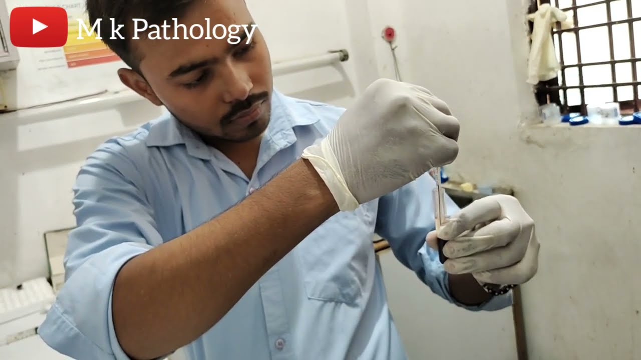 BLOOD CROSS MATCH | M K PATHOLOGY| | Lab Technician| |Pathology| | blood cross match tips |