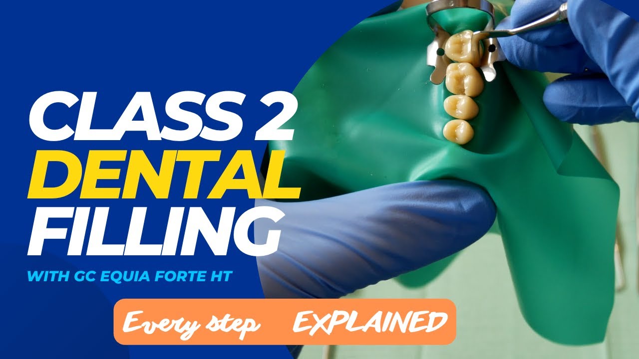 Class 2 Dental Filling with GC Equia Forte HT - All Steps EXPLAINED