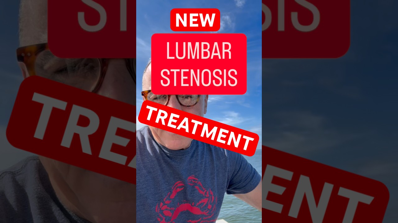 New lumbar stenosis treatment #LumbarStenosis #Laminectomy #SpineSurgery #endoscopicspinesurgery