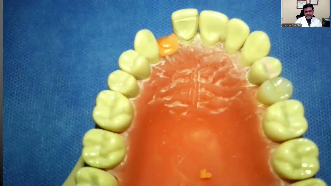 Adhesive Dentistry Magic! - Presented by Jose-Luis Ruiz, DDS