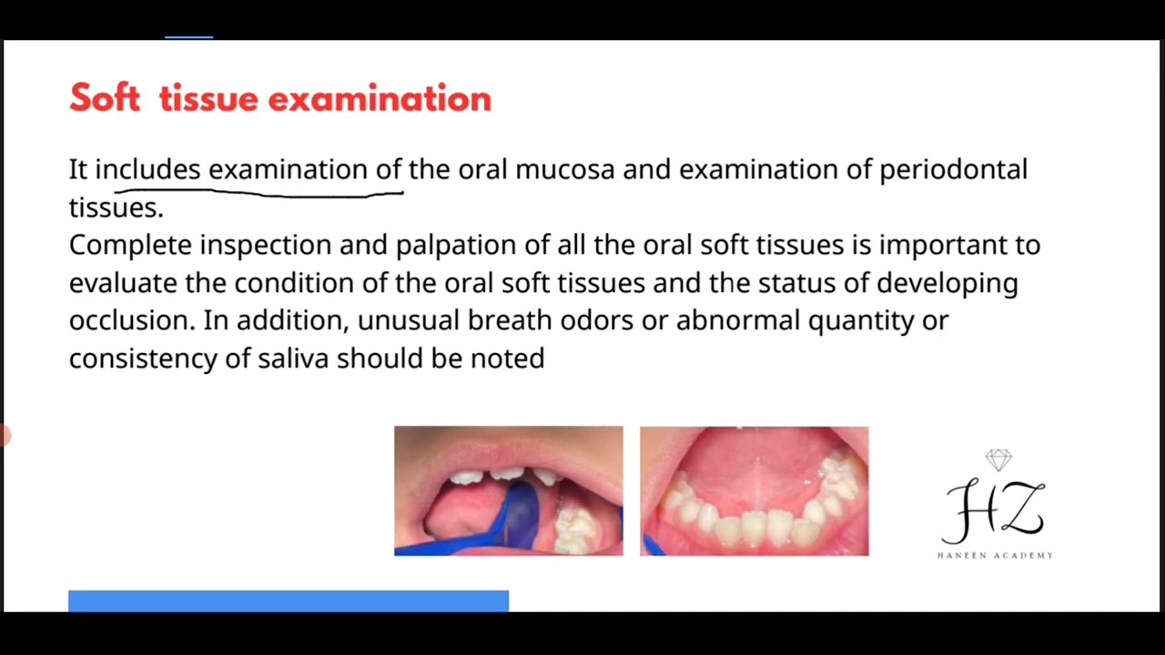 Pedodontics 5th lec 2  Examination of the Mouth (Continue..)💙