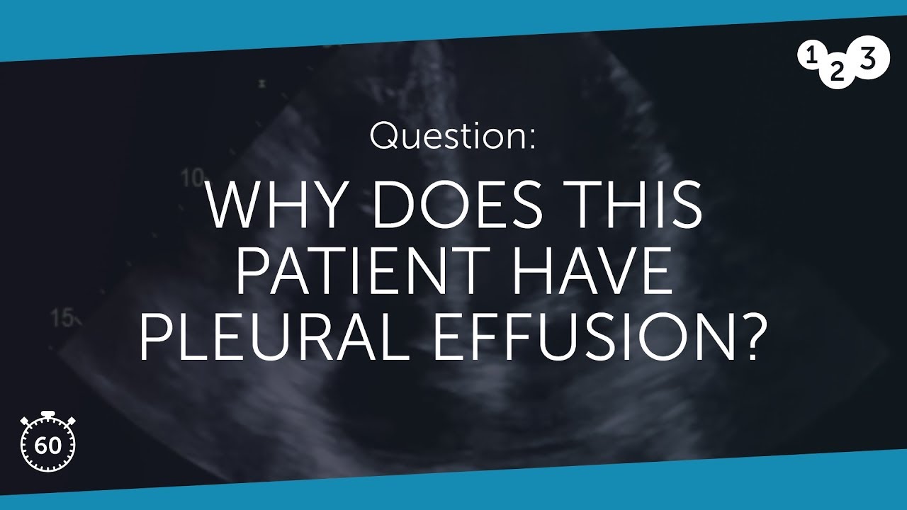 60 Seconds of Echo Teaching Question: Why does this patient have pleural effusion?