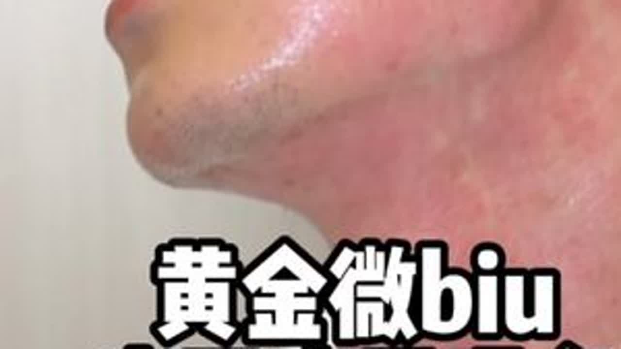34岁，微针解决青春期留下的坑！#护肤分享#金达威聚臻美 #聚臻美黄金微针