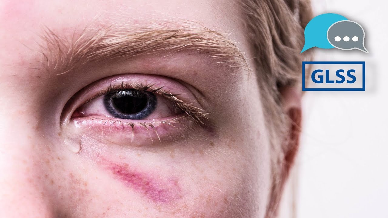 SPOTLIGHT: Intersection of Trauma and Homelessness