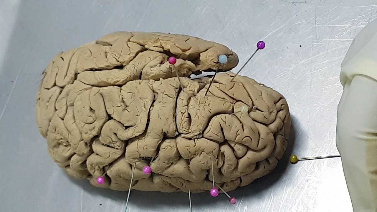 Hemisferios cerebrales: Cisuras, surcos, áreas y lóbulos - NeuroAnatomia - UCSur - Parte 1/3