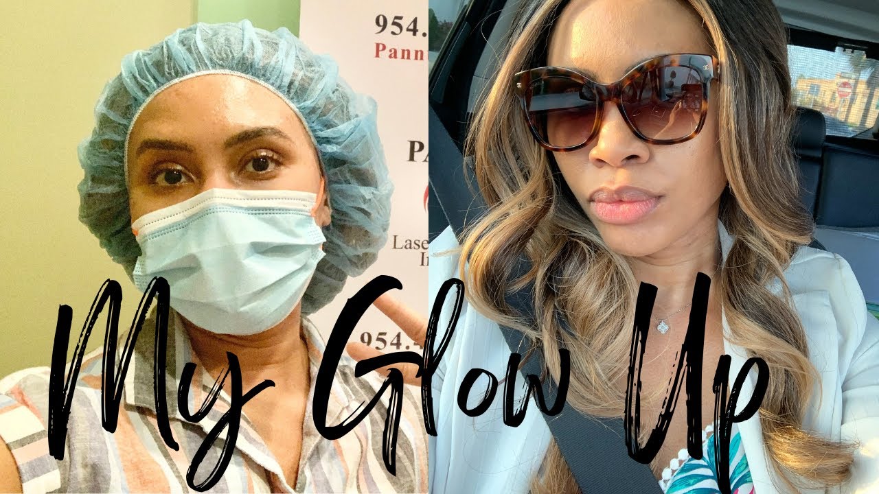 MY LIFE CHANGING GLOW UP | Surgery, New Mindset, New Clothes