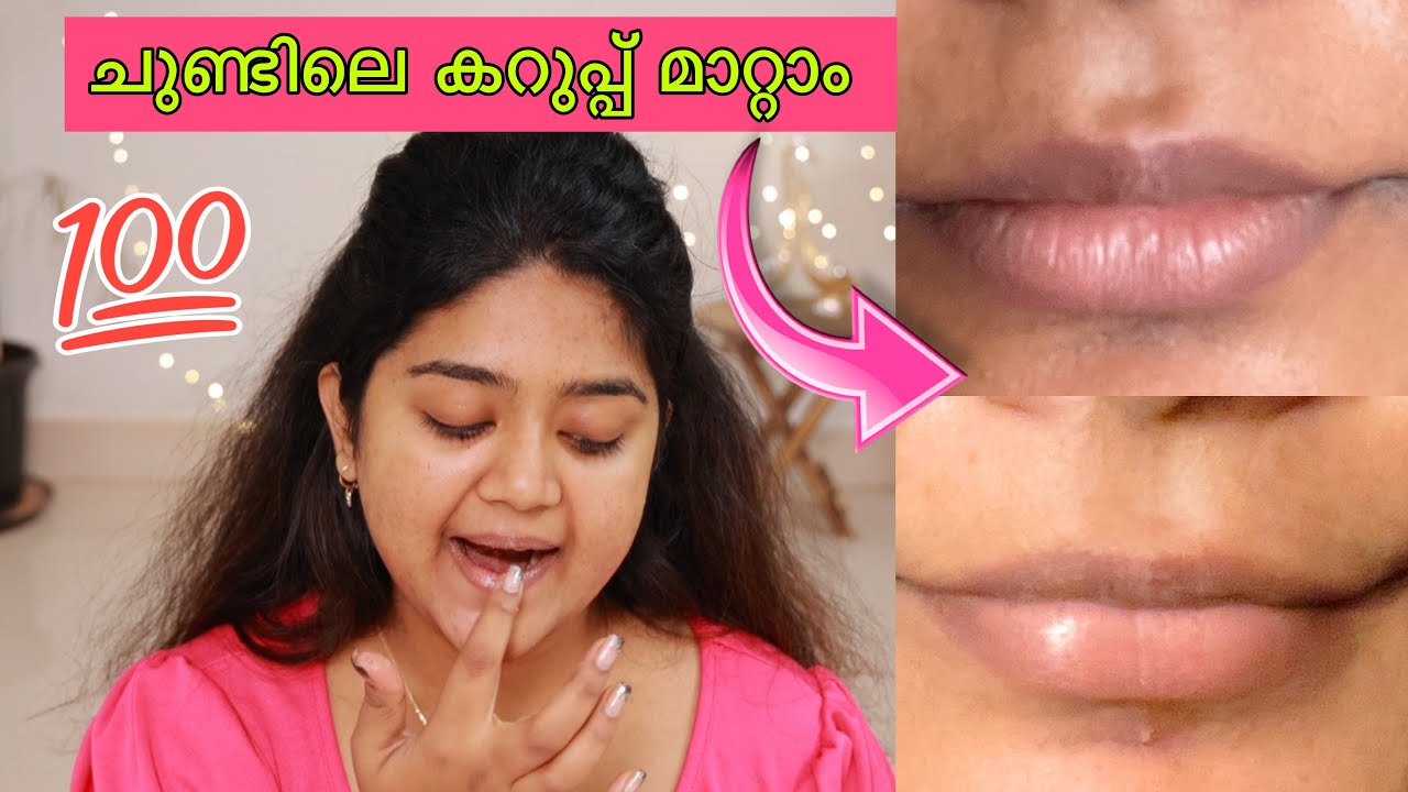 How I reduced my lip pigmentation🔥