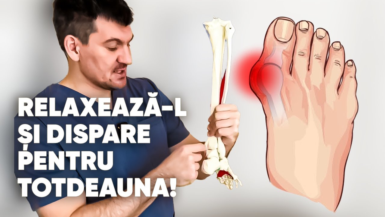 Relaxează acest mușchi și montul dispare pentru totdeauna! Încearcă și tu!