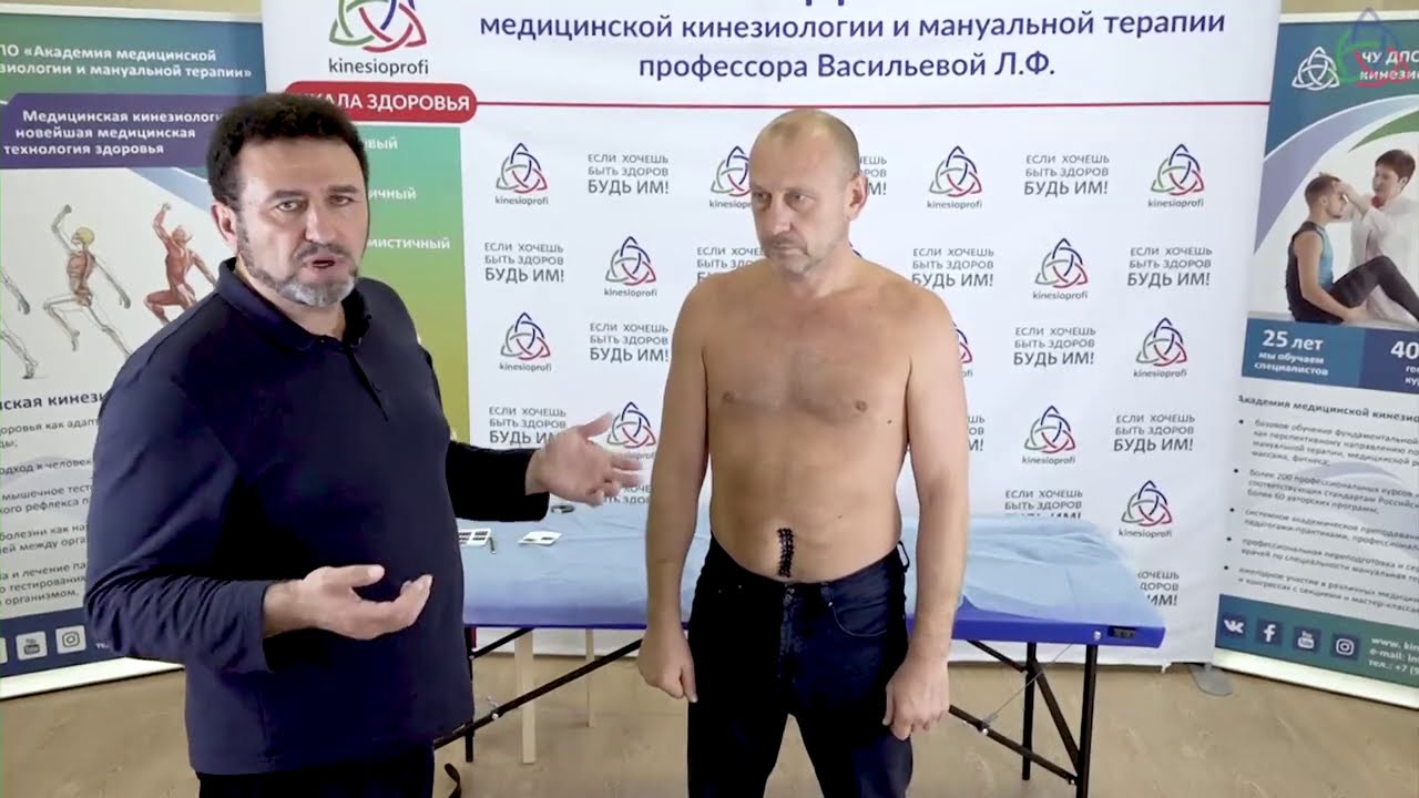 Кинезиологическое кросстейпирование рубцов и шрамов