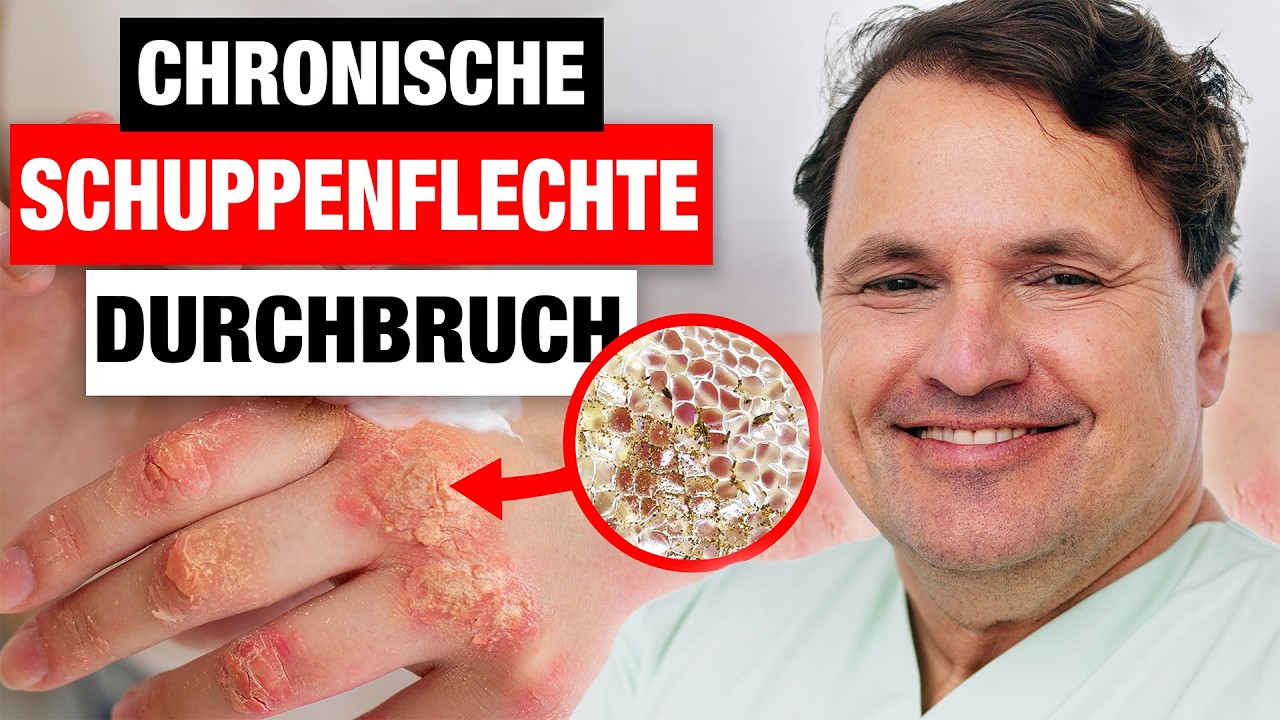 Schuppenflechte (Psoriasis) behandeln: Ursachen, Symptome & Empfehlungen