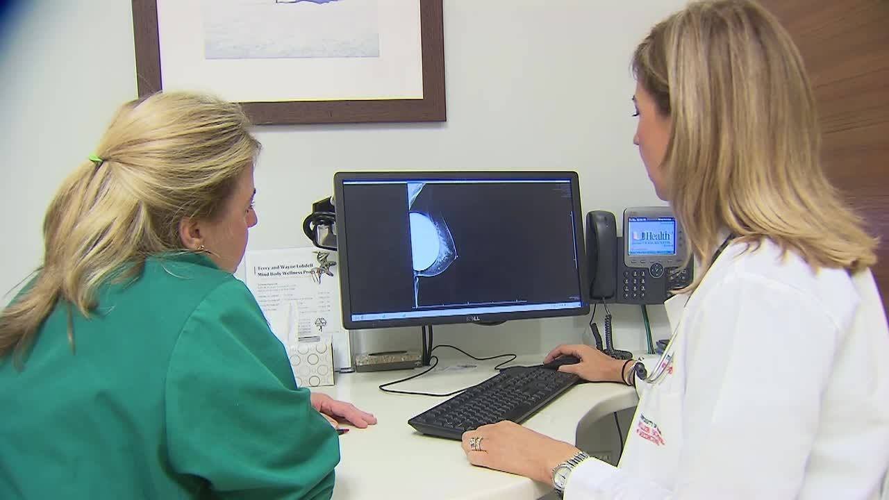 Researchers say no evidence for suggestion to end mammograms at age 75
