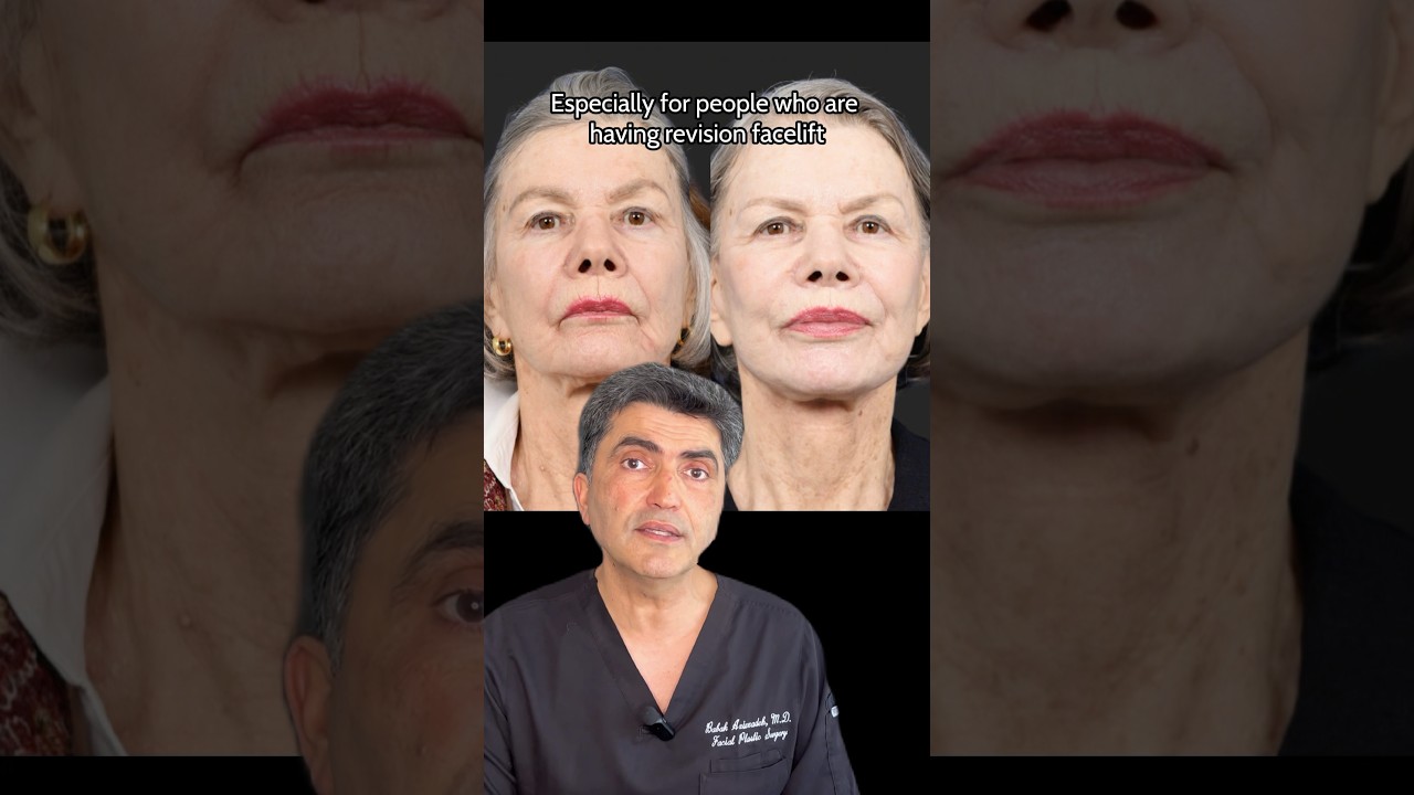Hyperbaric oxygen for facelifts ? #hyperbaricoxygentherapy #facelifts #plasticsurgery