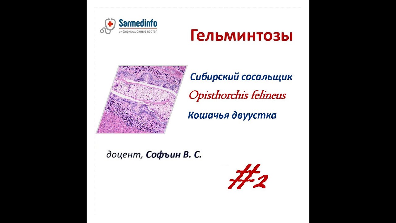 Гельминтозы | Сибирский сосальщик