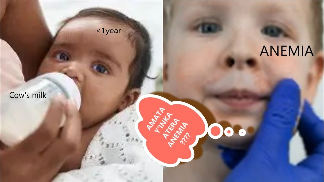 GUHA AMATA Y'INKA IMWANA URI MUNSI Y'UMWAKA BITERA ANEMIA ?