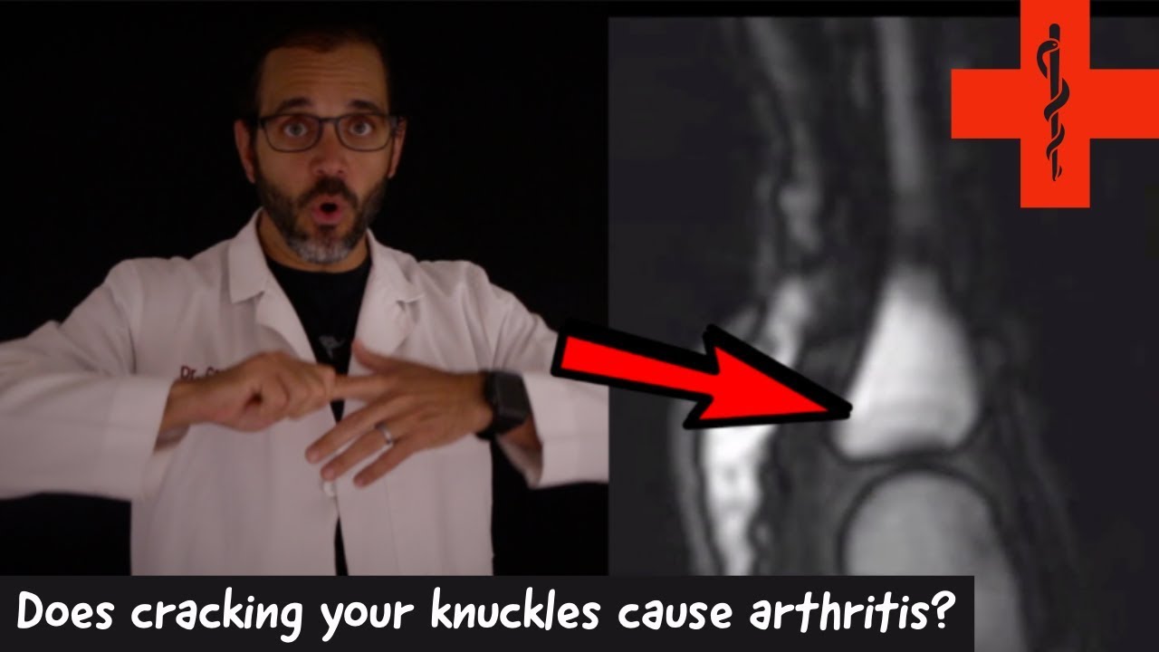 Does you cracking or popping your joints lead to arthritis?