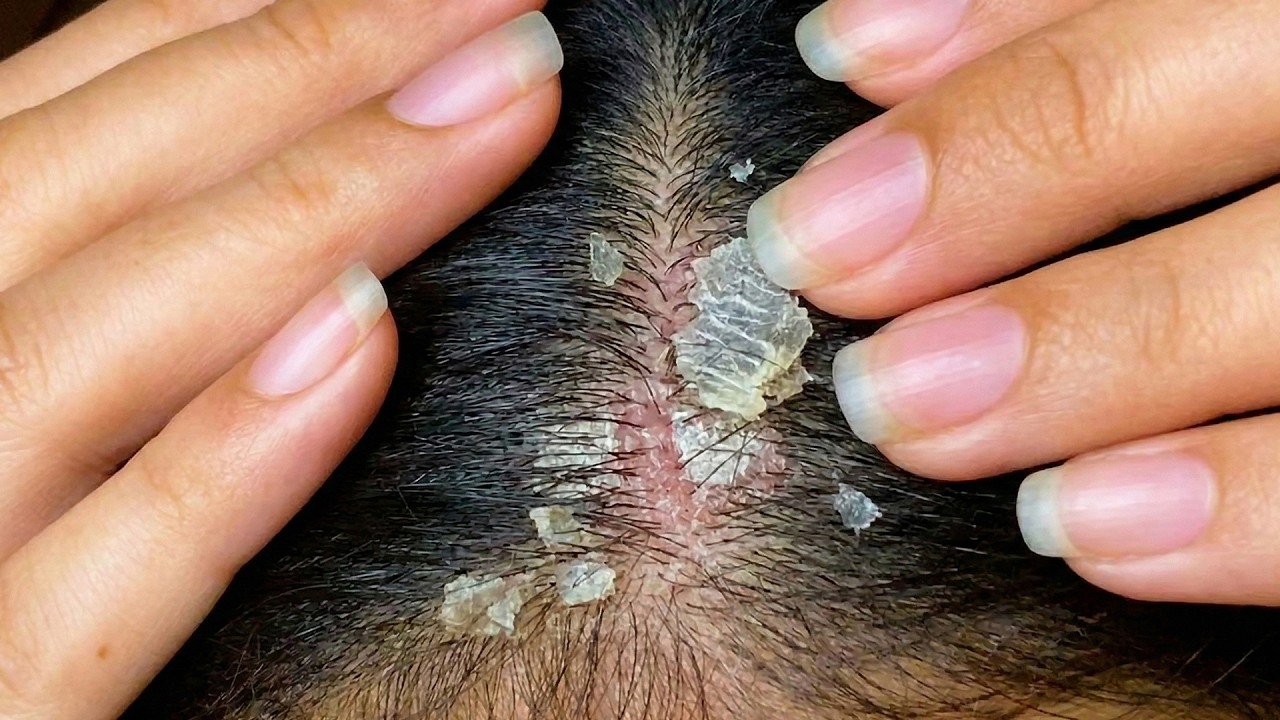 Hair Brushing & Scalp Scratching ASMR #S0050