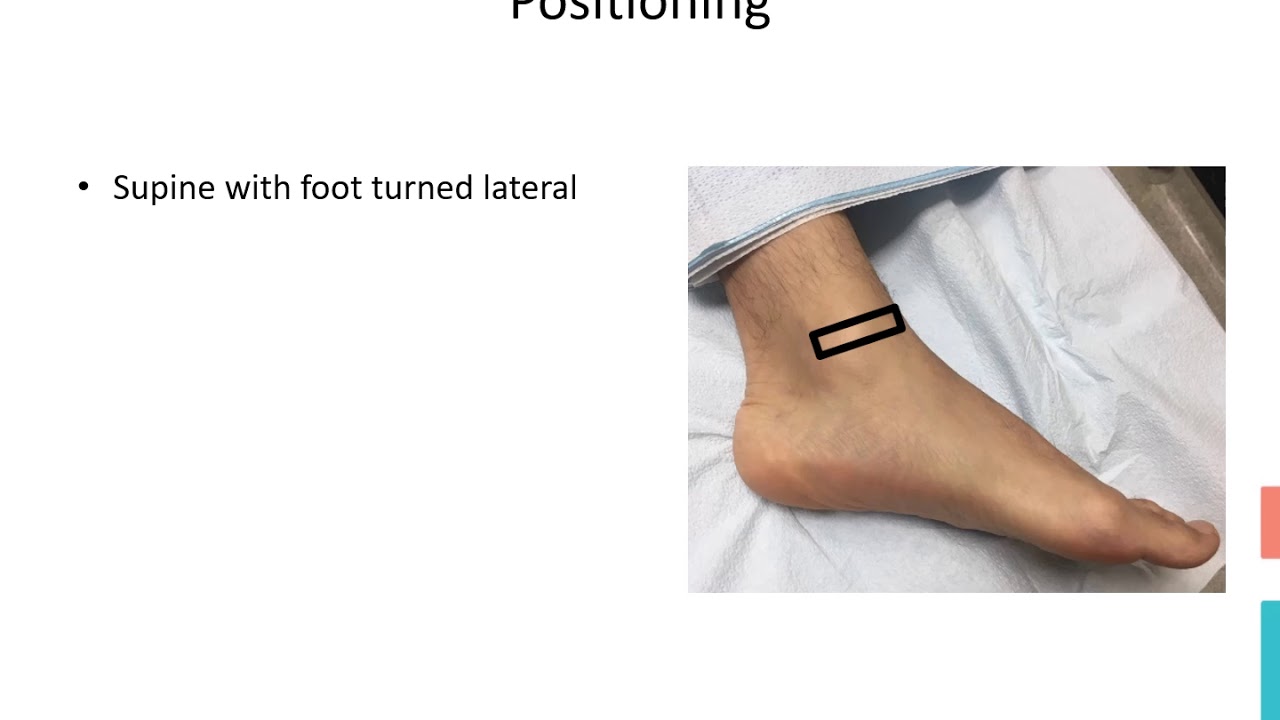 Saphenous Nerve Ankle Block