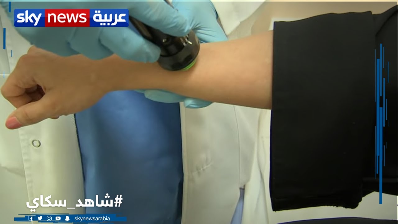مرض الصدفية طرق العلاج القديمة والحديثة