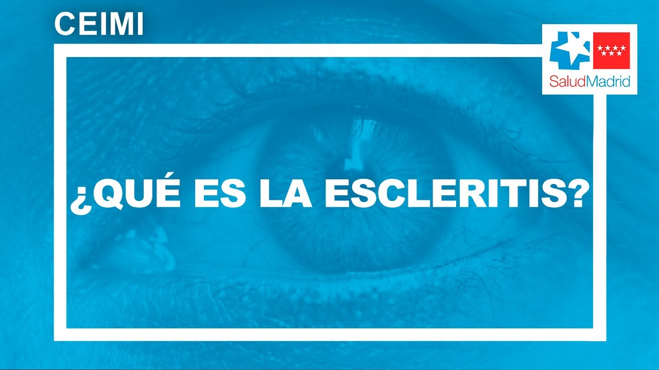 &iquest;Qu&eacute; es la escleritis? | CEIMI - Hospital Gregorio Mara&ntilde;&oacute;n