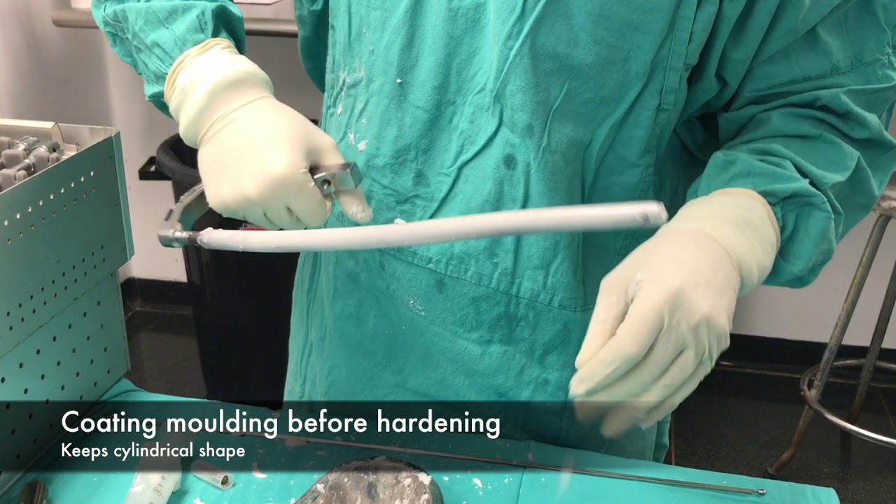 Self manufacturing of an antibiotic loaded nail
