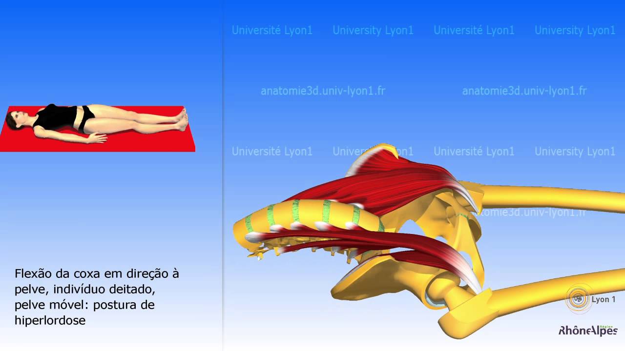 Iliopsoas