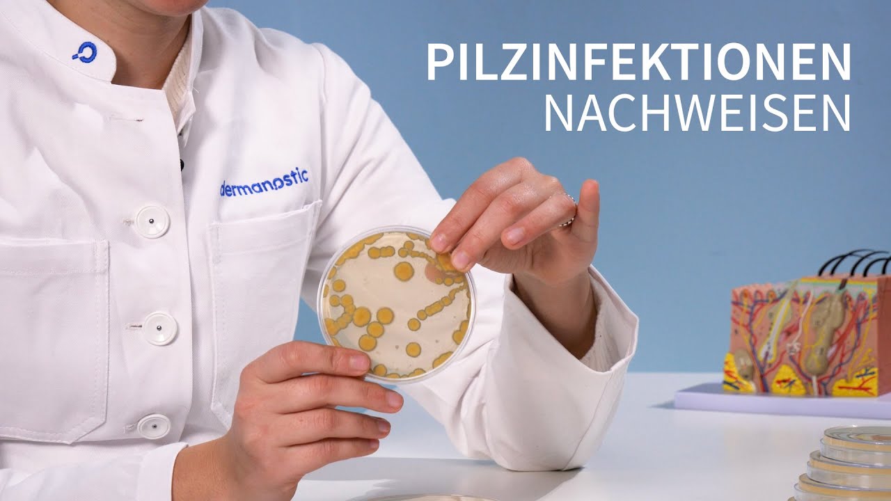 Hautpilz erkennen - So funktionert der Nachweis │Dr. med. Alice Martin