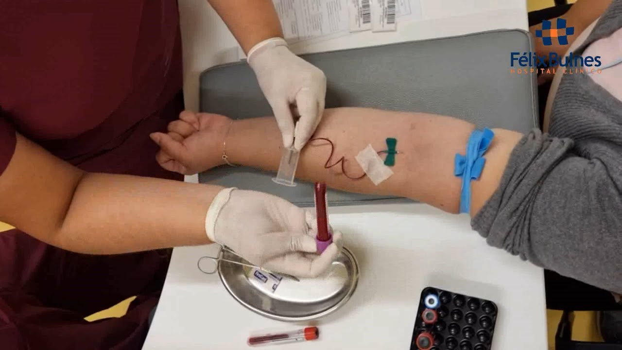 Procedimiento de Toma de Muestras con Sistema al Vacío (Extracción Mixta)