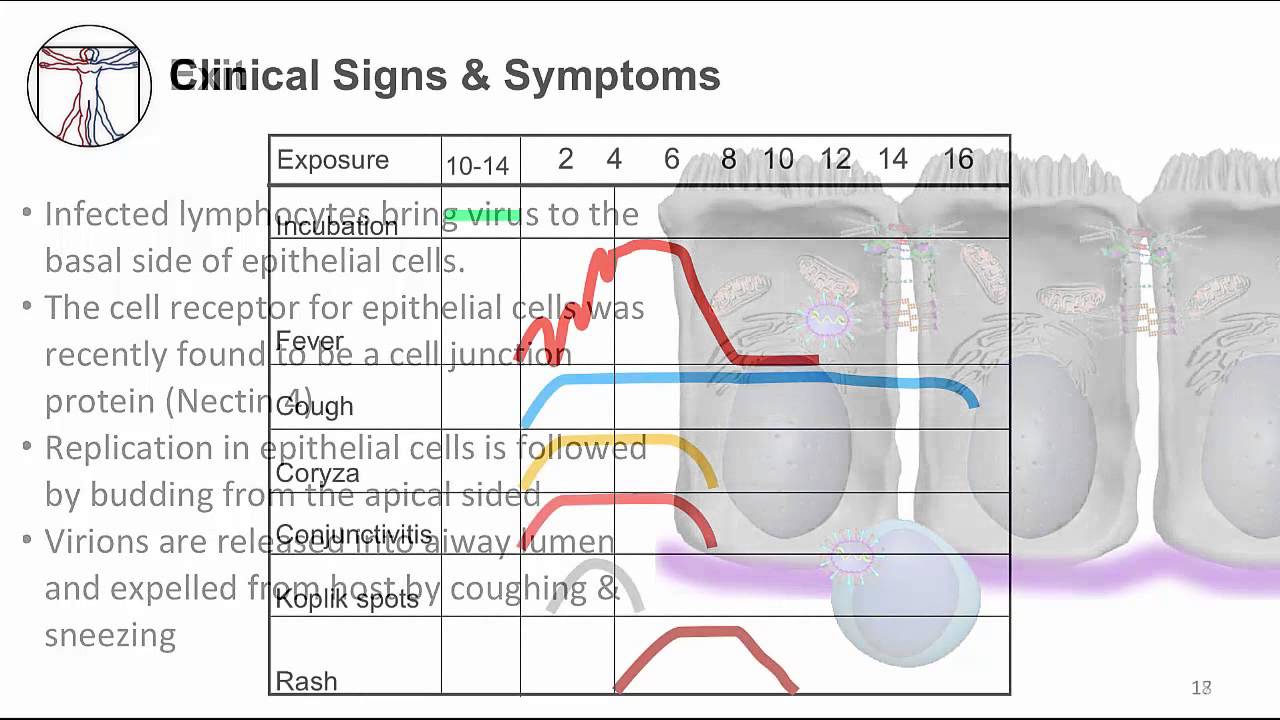 Measles and vaccines: measles virus