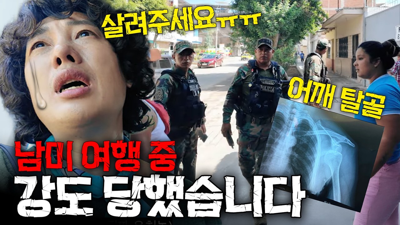 페루에서 날치기 당하고 수술했습니다.. 남미 여행의 현실 페루(1)