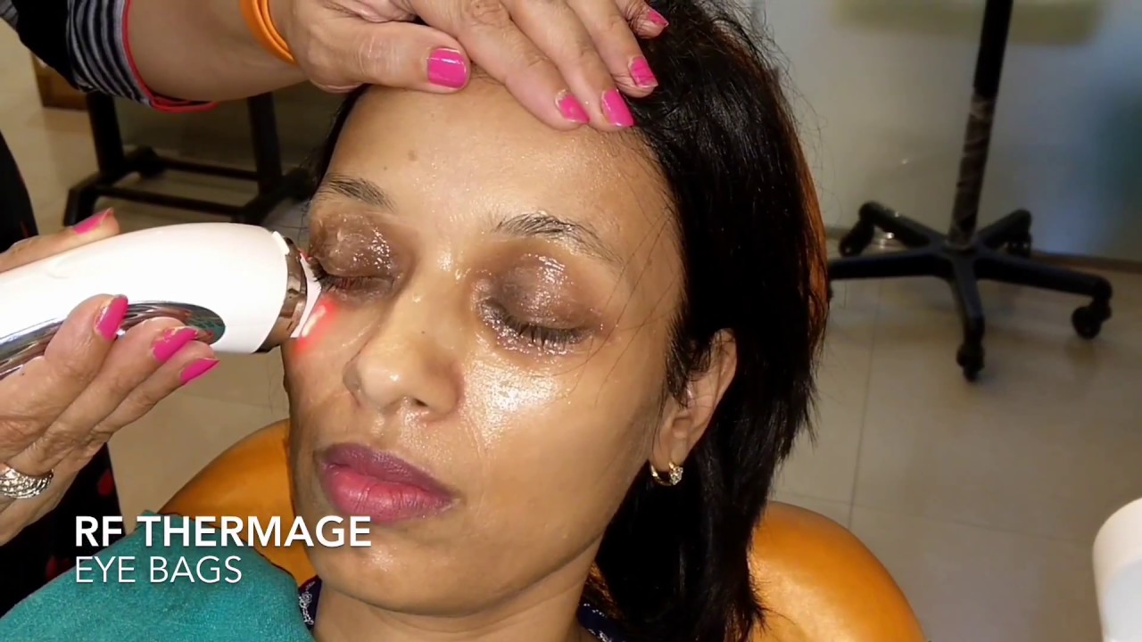 Treating Dark Circles & Under Eye Bags