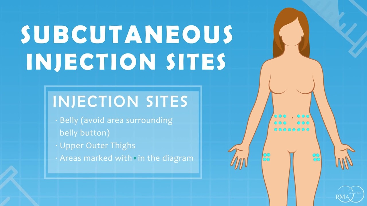 Gonal-f RFF Redi-ject Pen Injection Instruction by Fertility Nurse