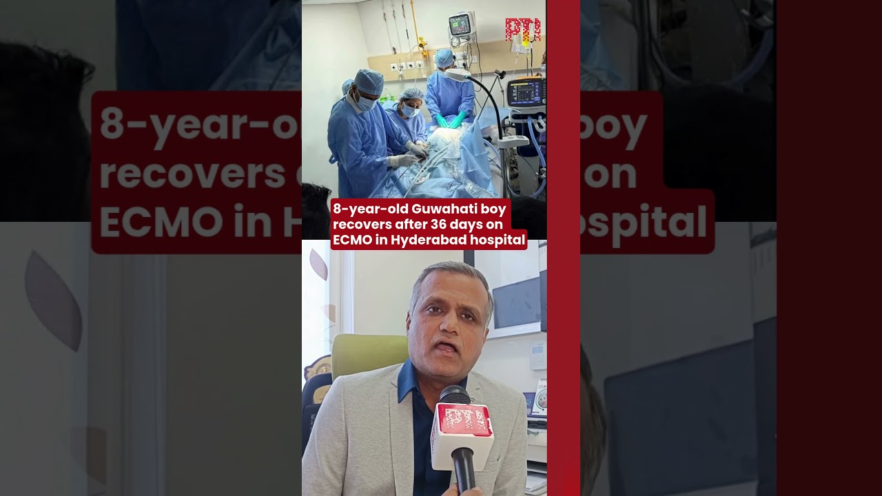 8-year-old Guwahati boy recovers after 36 days on ECMO in Hyderabad hospital